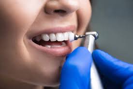 Limpeza dentária